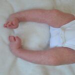 Achilleus_VyhnalkovaTina (1)