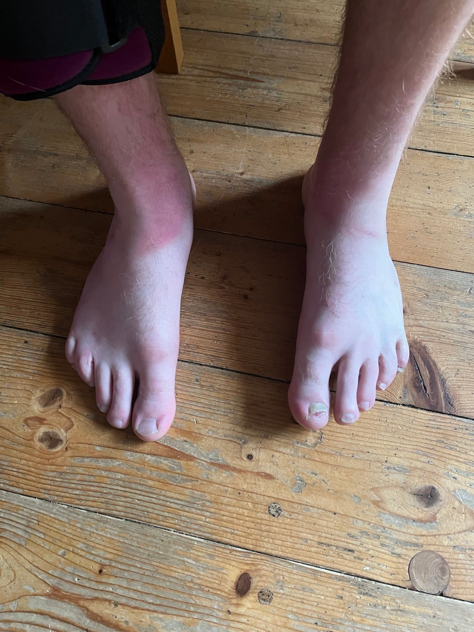 Lukáš_nohy Lukáš_nohy